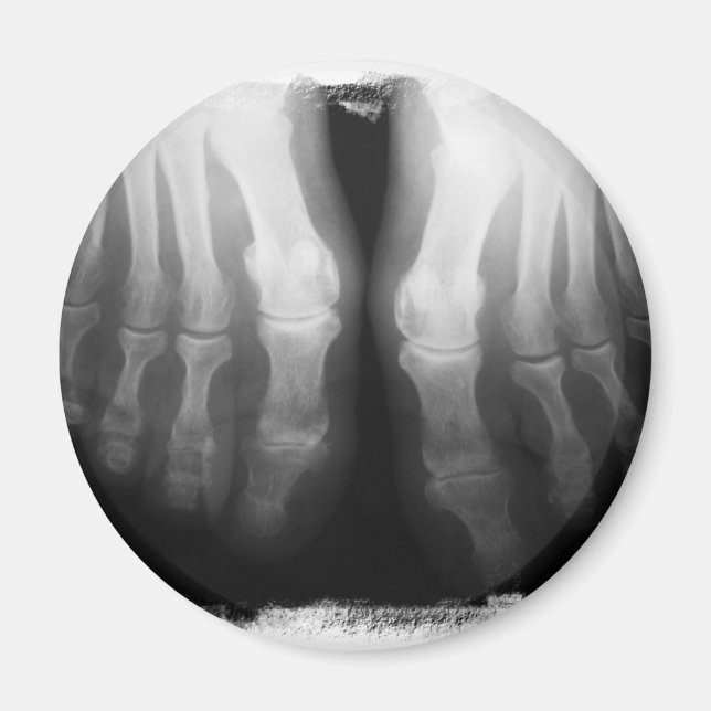 X-Ray füttert menschliche Skelettknochen schwarz & Magnet (Vorne)