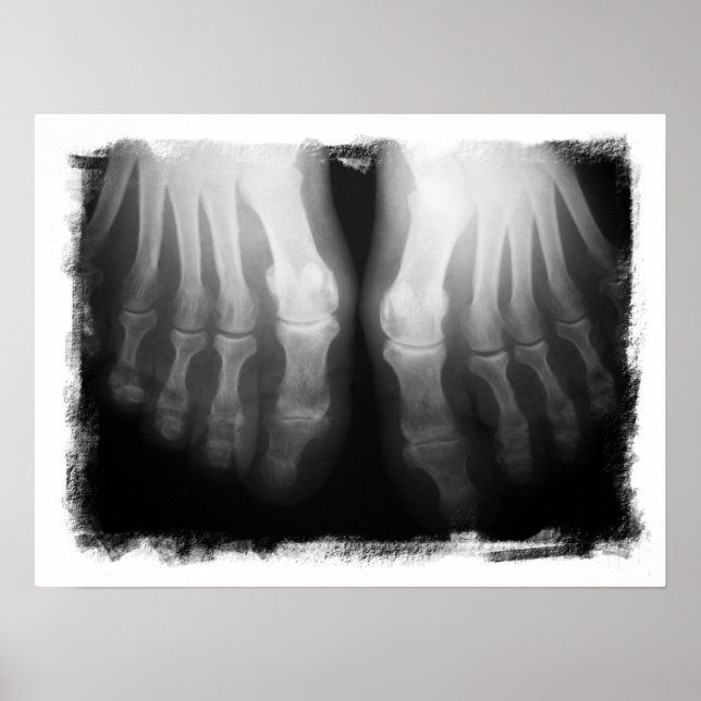 X-Ray füttert menschliche Skelettknochen schwarz & Poster (Vorne)