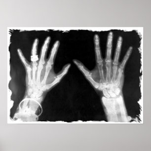 X-Ray Skeleton Hands & Schmuck - B&W Poster