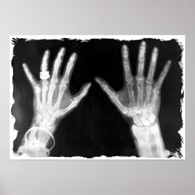 X-Ray Skeleton Hands & Schmuck - B&W Poster (Vorne)