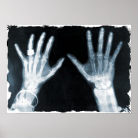 X-Ray Skeleton Hands & Schmuck - Blau