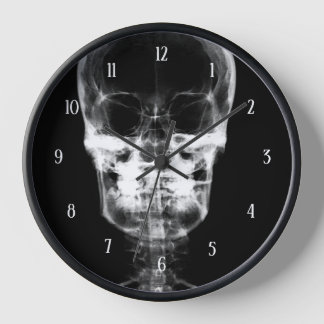 X-Ray Skull - B&W Uhr
