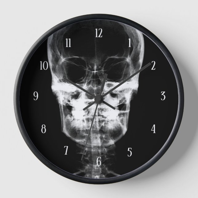 X-Ray Skull - B&W Uhr (Vorderseite)