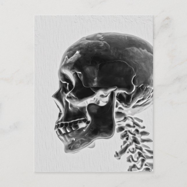 X-Ray Skull Postkarte (Vorderseite)