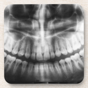 X-Ray Teeth Mouth Smile Black and White Getränkeuntersetzer
