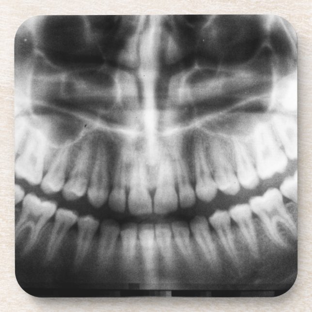 X-Ray Teeth Mouth Smile Black and White Getränkeuntersetzer (Vorderseite)