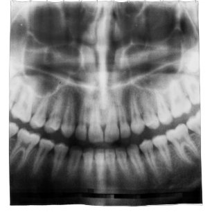 X-Ray Teeth Mouth Smile Schwarz-Weiß Duschvorhang