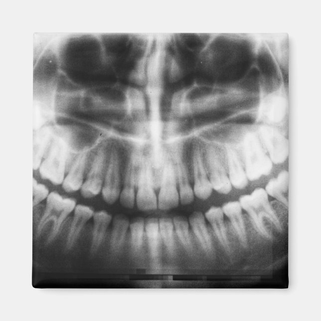 X-Ray Teeth Mouth Smile Schwarz-Weiß Magnet (Vorne)