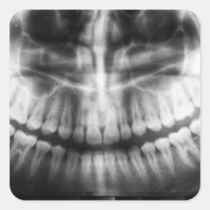 X-Ray Teeth Mouth Smile Schwarz-Weiß Quadratischer Aufkleber