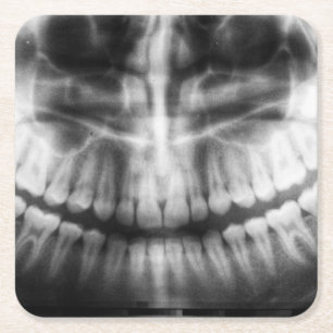 X-Ray Teeth Mouth Smile Schwarz-Weiß Rechteckiger Pappuntersetzer