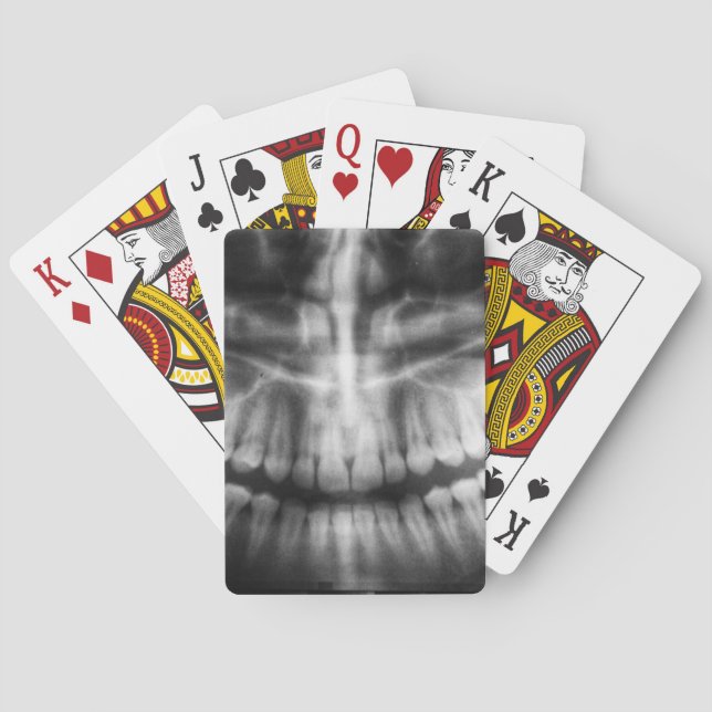 X-Ray Teeth Mouth Smile Schwarz-Weiß Spielkarten (Rückseite)