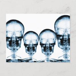 X-Ray Vision Skeleton Skull - Blue Postkarte