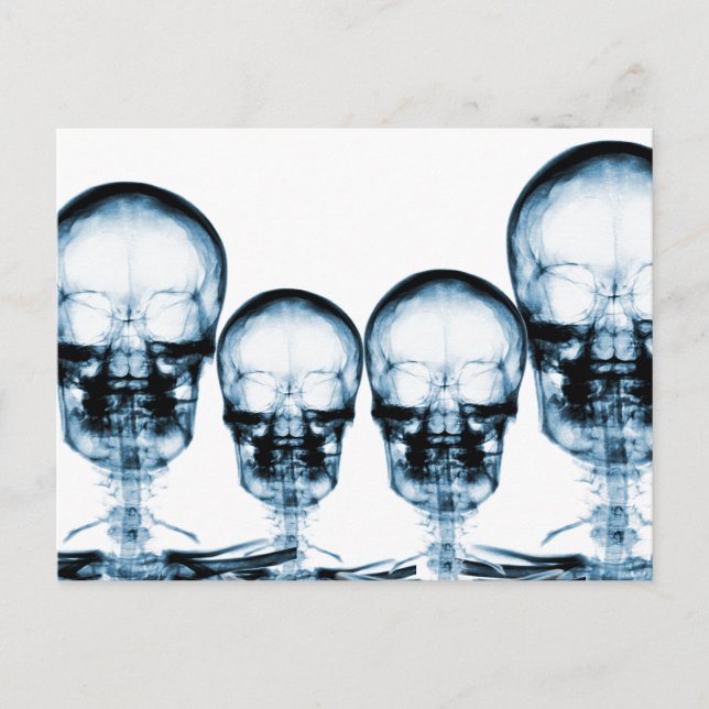 X-Ray Vision Skeleton Skull - Blue Postkarte (Vorderseite)