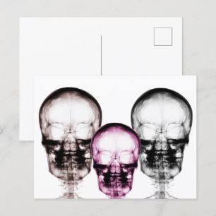 X-Ray-Vision-Skelettfächer in gemischten Farben Postkarte