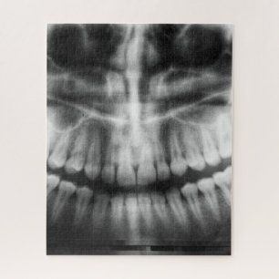 X-Ray Zähne Mouth Smile Schwarz und Weiß
