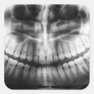 X-Ray Zähne Mouth Smile Schwarz und Weiß Quadratischer Aufkleber