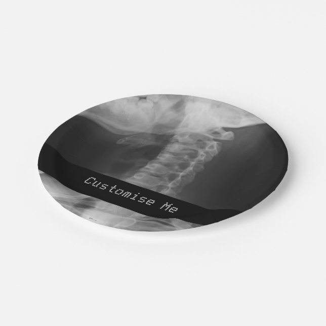 X-Rayed 2 (Original) Pappteller (Schrägansicht)