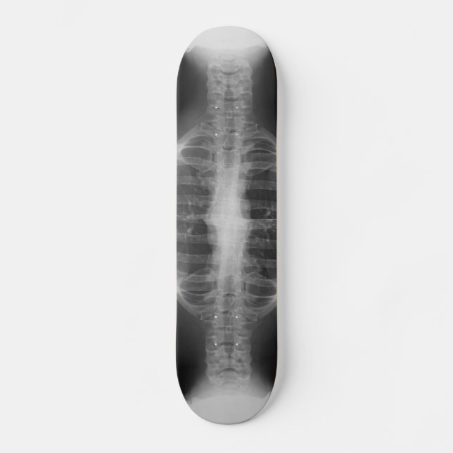 X-rayed 3 skateboard (Vorderseite)