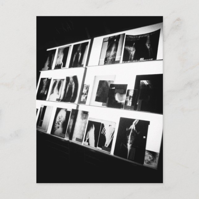 X-Rays Postkarte (Vorderseite)