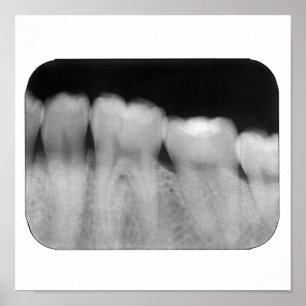 Zähne mit dem Füllen Poster