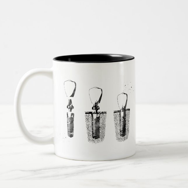 Zahnimplantationsverfahren Zweifarbige Tasse (Links)
