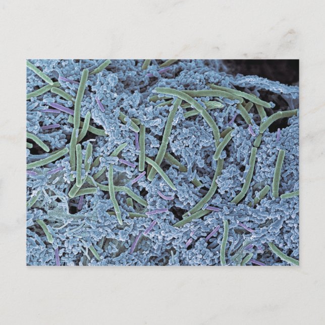 Zahnschild, farbiges Rasterelektronenelement Postkarte (Vorderseite)
