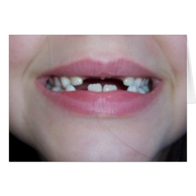 Zahnzähne (Vorderseite (Horizontal))