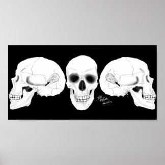 Zeigt den Schädel an, wenn die CIs entfernt wurden Poster